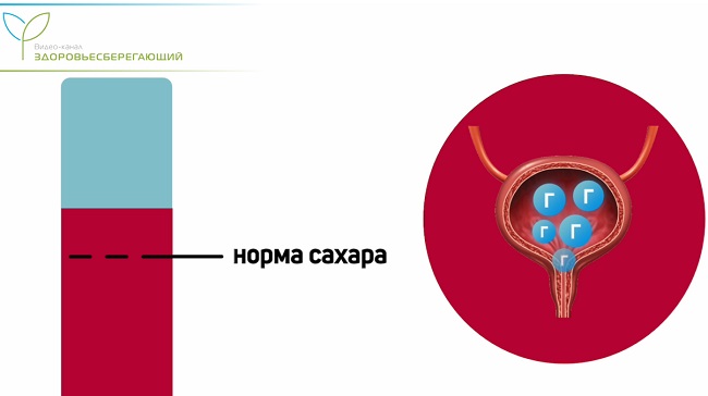 частое мочеиспускание