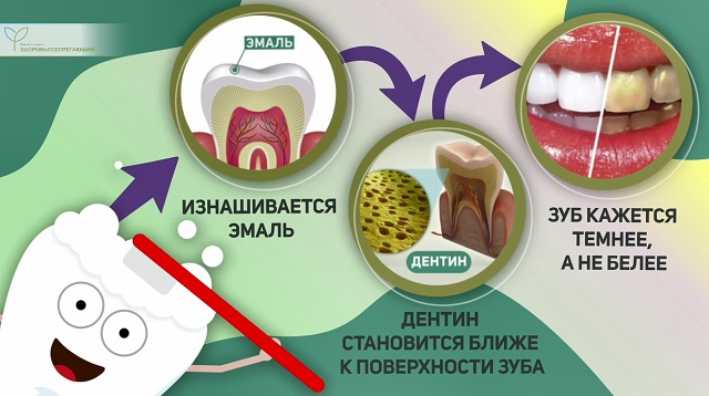Часто чистить зубы нельзя