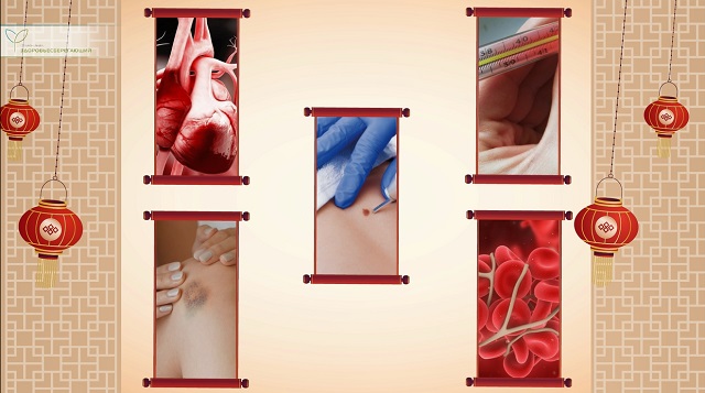 Противопоказания