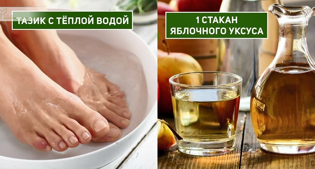 уход за ногтями