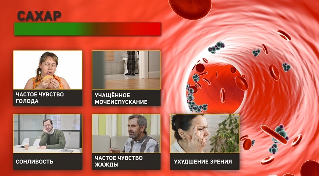 признаки высокого сахара в крови