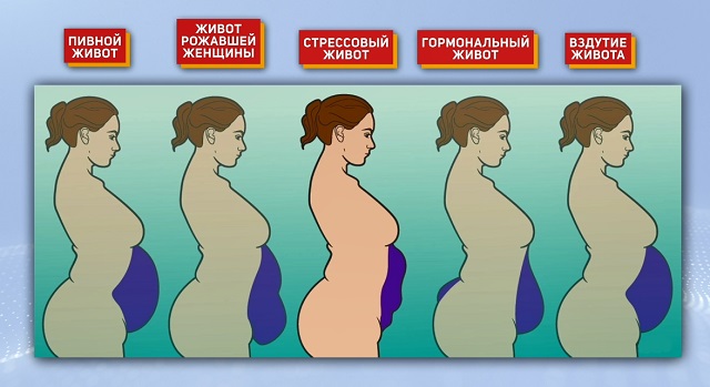 типы живота в зависимости от причины