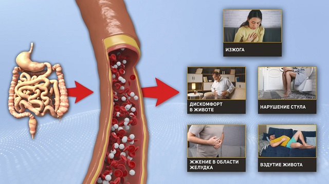 симптомы заболевания ЖКТ