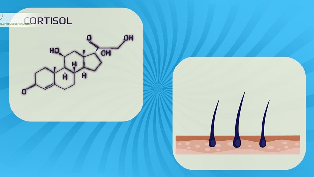 выпадение волос