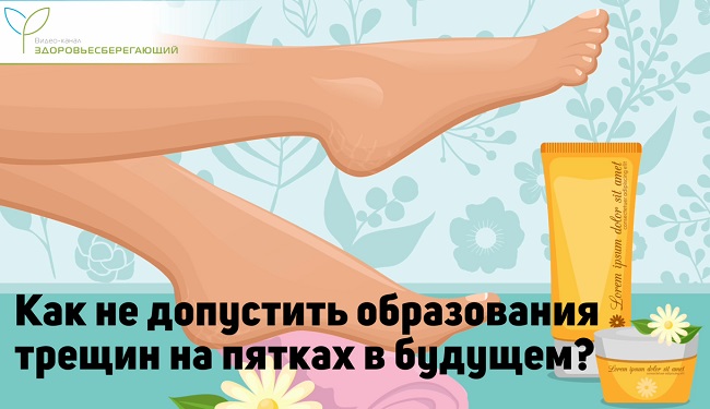 профилактика трещин на пятках
