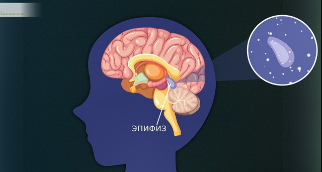 кальцификация шишковидной железы