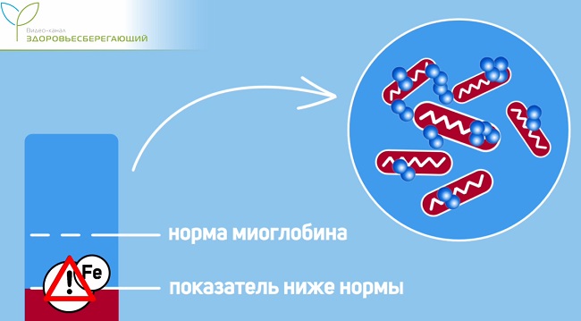 потеря выносливости