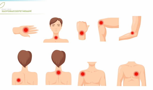 боль в суставах