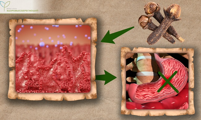 профилактика язвы желудка