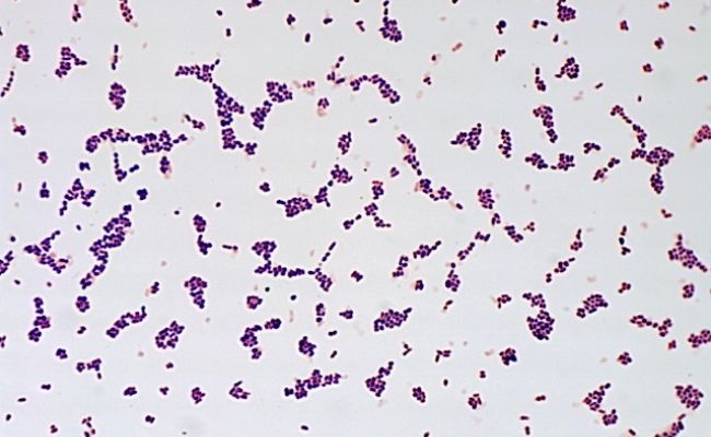 Cutibacterium acnes под микроскопом