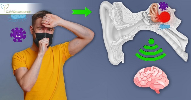 Лабиринтит