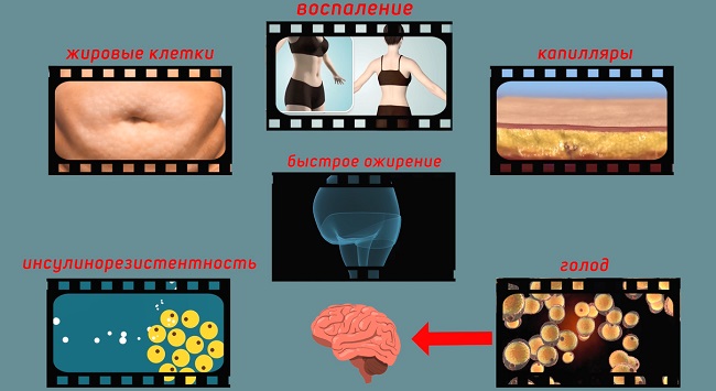 полнота и ожирение