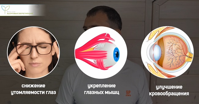 Соляризация