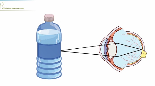 Причины нарушения зрения