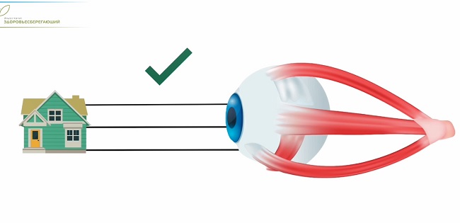 Близорукость по Бейтсу