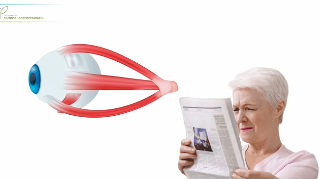 Близорукий