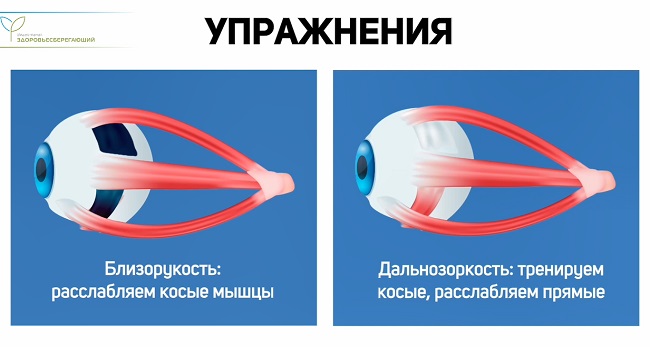 упражнения для глаз
