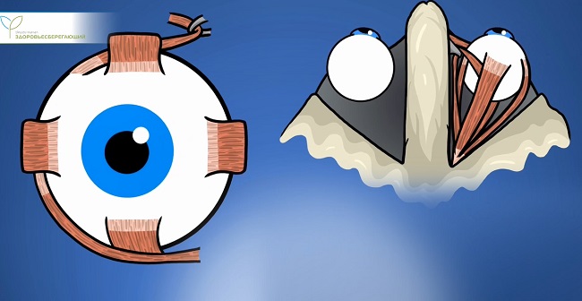 отказаться от очков