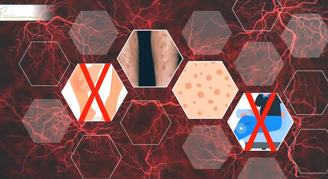 пятна на ногах