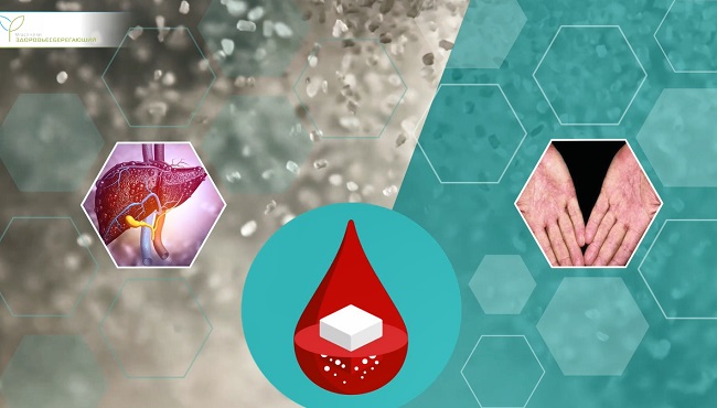 красные ладони