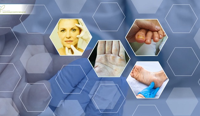 пожелтение кожи