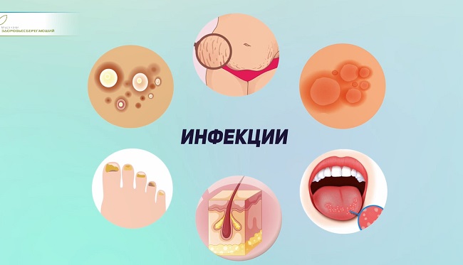 кожные инфекции