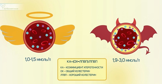 коэффициент атерогенности