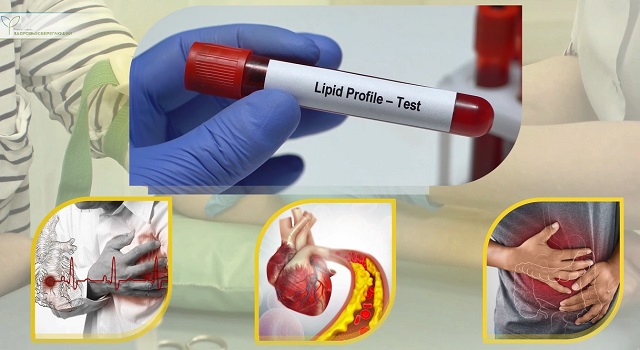 что такое липидный профиль