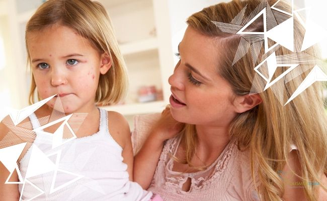 Симптомы ветрянки у девочки