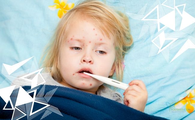 Корь у ребенка