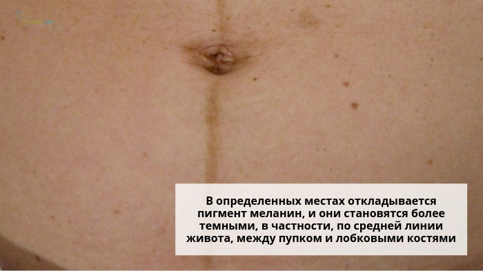 Темная полоска на животе у беременной