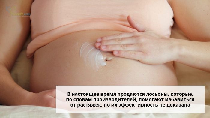 Лосьон от растяжек на животе
