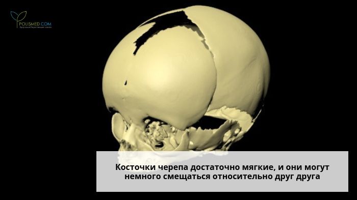 Череп плода на 33 неделе