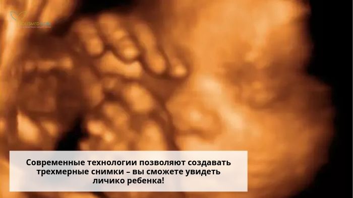 Личико плода на УЗИ