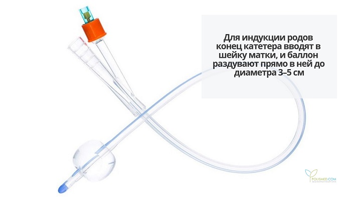 Катетер Фолея