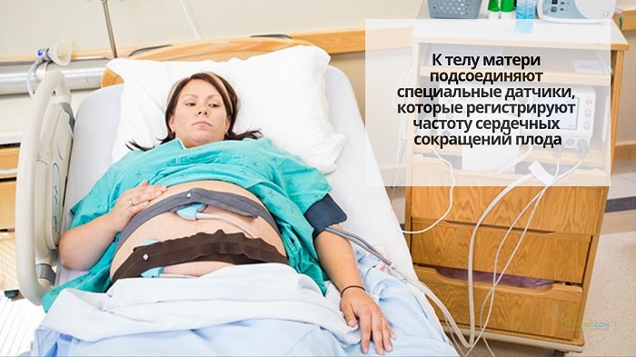 Беременная женщина проходит нестрессовый тест