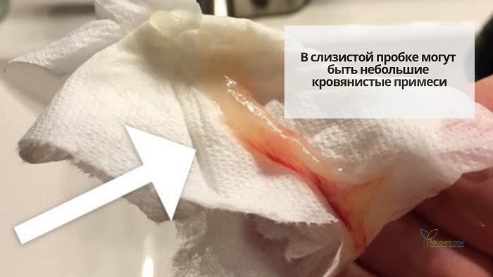 Слизистая пробка на салфетке