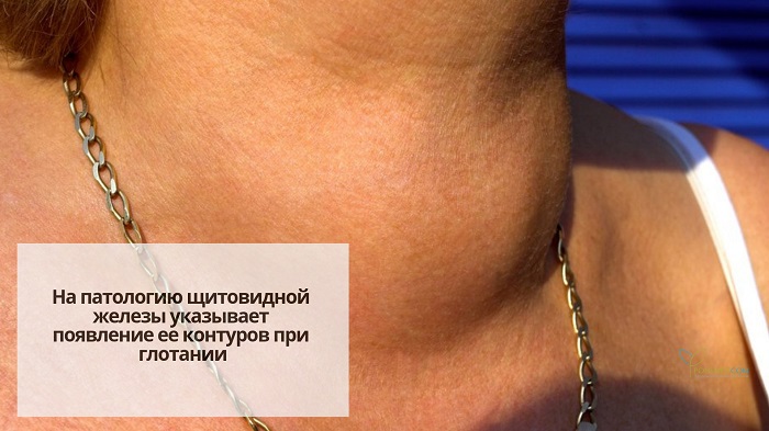 Как по бровям щитовидку проверить Как по бровям щитовидку проверить thumbnail