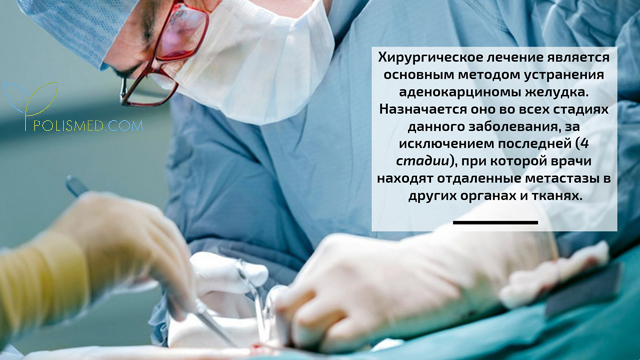 Операция при аденокарциноме желудка