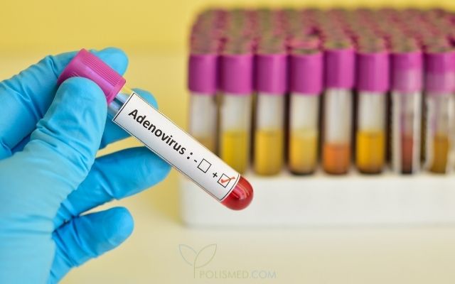 Диагностика аденовирусной инфекции