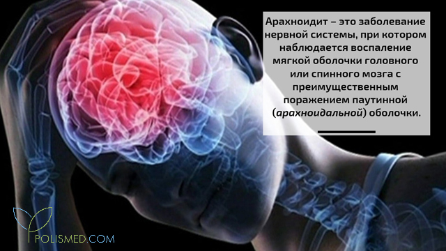 Арахноидит что это такое симптомы лечение. arahnoidit1. Арахноидит что это такое симптомы лечение фото. Арахноидит что это такое симптомы лечение-arahnoidit1. картинка Арахноидит что это такое симптомы лечение. картинка arahnoidit1.