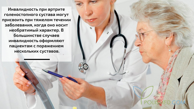 Инвалидность при артрите голеностопного сустава