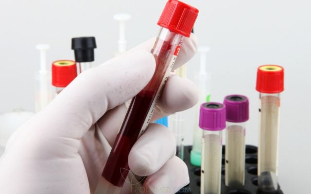 Анализ и норма биохимический анализ крови thumbnail