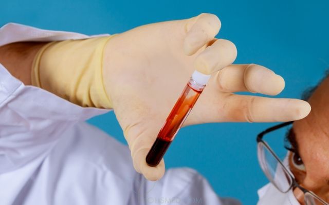 Нормы показателей состава крови и биохимический thumbnail