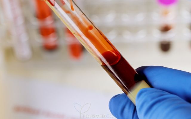 12 показателей биохимического анализа крови, которые должны знать все thumbnail