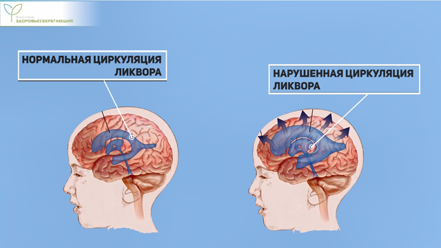 Циркуляция ликвора