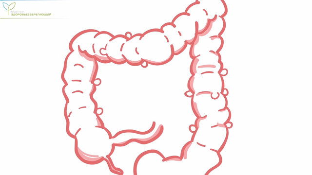 Дивертикулит