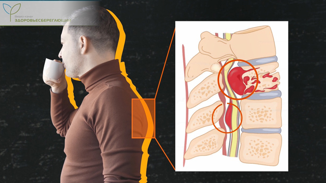Метастазы при раке