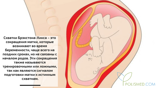 что такое схватки брекстона хикса и как их распознать. Смотреть фото что такое схватки брекстона хикса и как их распознать. Смотреть картинку что такое схватки брекстона хикса и как их распознать. Картинка про что такое схватки брекстона хикса и как их распознать. Фото что такое схватки брекстона хикса и как их распознать