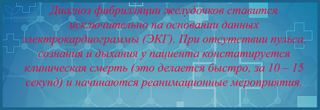диагноз ставится на основании данных электрокардиограммы